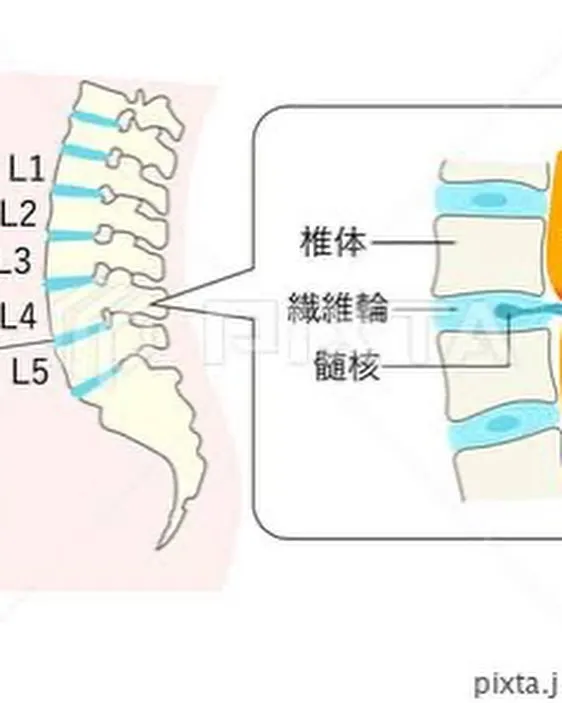 『腰痛』で悩んでいる方へ😓