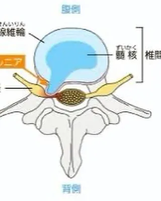 『腰痛』で悩んでいる方へ😓